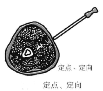 针刀操作技巧 初学者必看